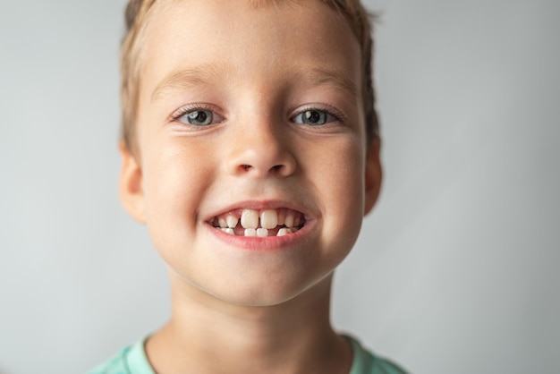 Foto il bambino mostra i denti da latte odontoiatria pediatrica e periodontologia correzione del morso closeup