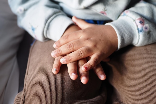 child suffering from itching skin on hand