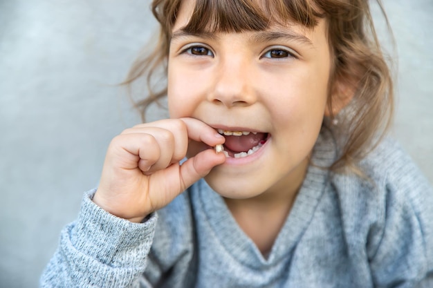 The child tooth fell out. Selective focus. Kid.