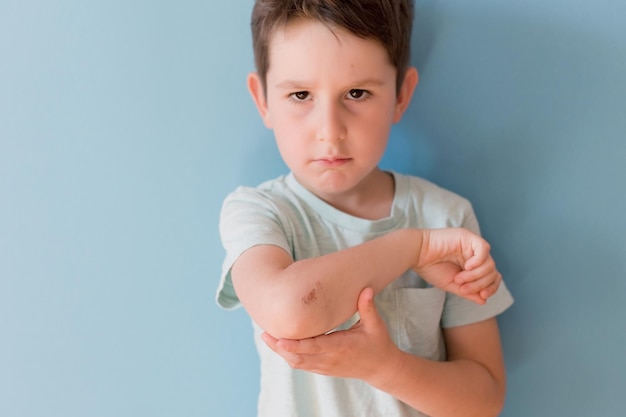 Photo child with grazed hand blue background