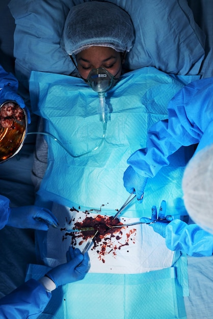 Chirurgie patiënt en medisch gereedschap met handen met bloed in het ziekenhuis voor noodgevallen met team van artsen Operatie chirurg en groep met werken aan anatomie voor letsel in de kliniek met zicht van boven