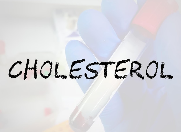 Cholesterol term for medical conceptual image.