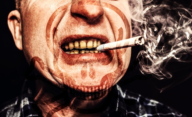 남자의 입에 담배입니다. 플라크 치아 충치 및 paradontosis. 흡연은 충치 문제와 나쁜 미소를 유발합니다. 치과 치료 개념입니다. 해로운 습관. 해골 기호입니다.