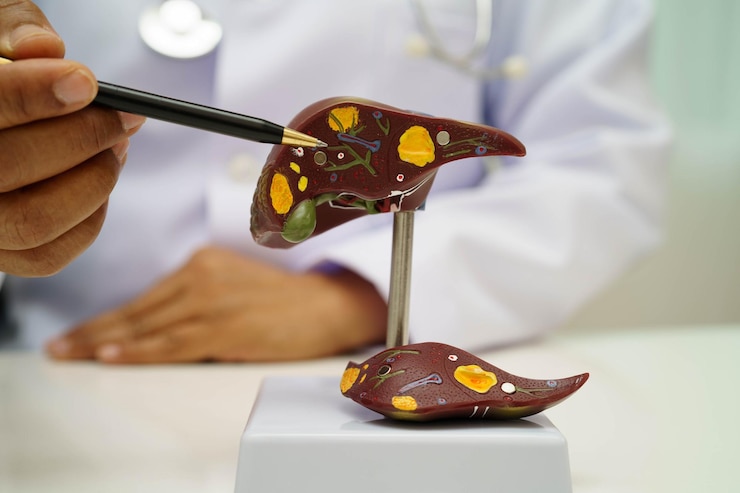 Photo cirrhosis liver cancer fatty liver asian doctor with liver human anatomy model in world hepatitis day at hospital