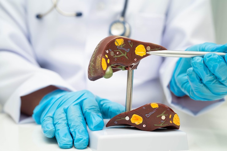 Photo cirrhosis liver cancer fatty liver asian doctor with liver human anatomy model in world hepatitis day at hospital