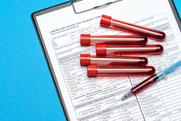 Clipboard with paper blank form with blood test tubes on blue background.