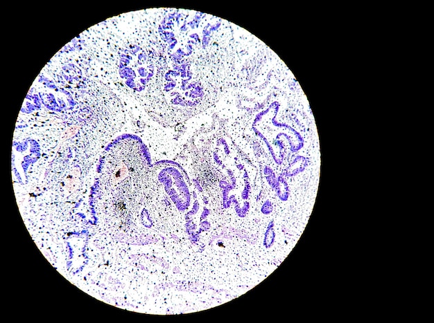 Close microscopic view of histopathological stained slide