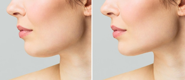 a close portrait of an aged woman before and after facial rejuvenation procedure correction of the