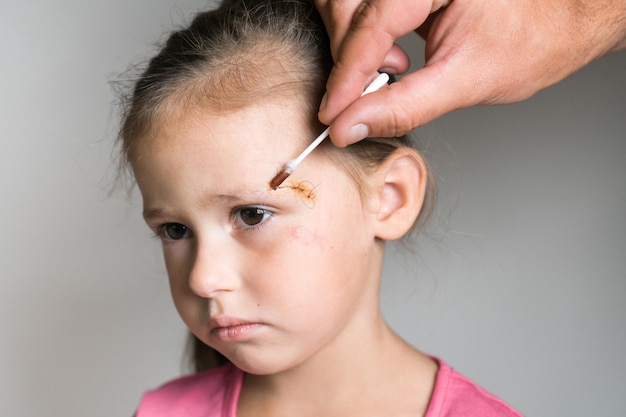 Close up almost crying sad kid girl face with cropped man hand\
healing and cleaning trauma with iodine on cotton swab