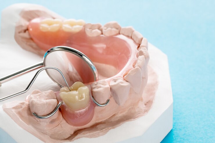 Close up, Artificial removable partial denture or temporary partial denture 