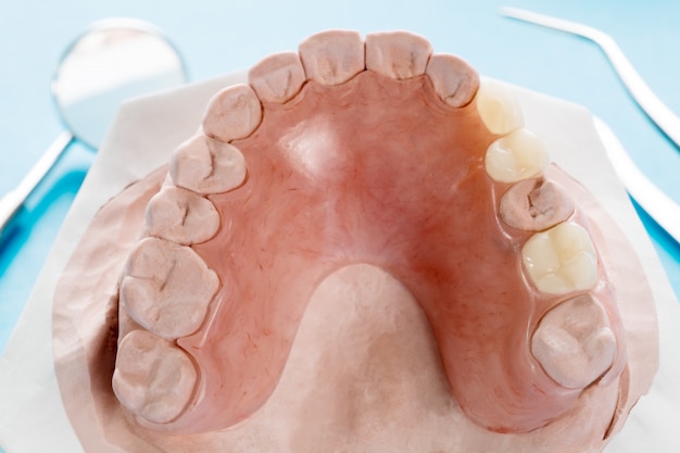 Close up, Artificial removable partial denture or temporary partial denture