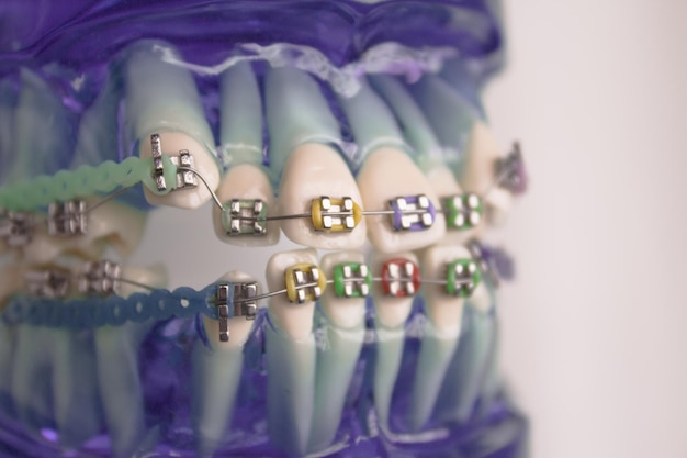 Photo close-up of artificial teeth