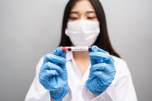 Primo piano del medico asiatico in possesso di un campione di sangue in provetta di coronavirus indossando camice da laboratorio, maschera bianca e guanti di nitrile blu per la protezione contro l'infezione da virus contagioso