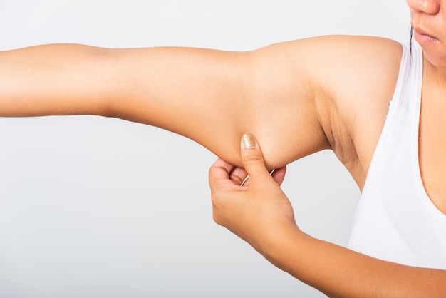 Foto chiuda su della donna asiatica che tira il grasso in eccesso su lei sotto il braccio, la pelle dell'ascella di problema, studio isolato su fondo bianco