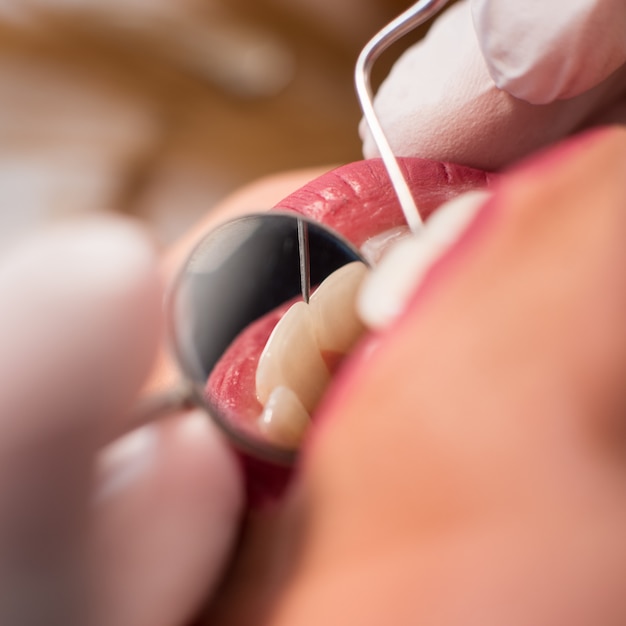 Close up of beautiful young woman having dental check up. Dentist examining a patient's teeth, holding dental tools - mirror and probe. Dentistry.