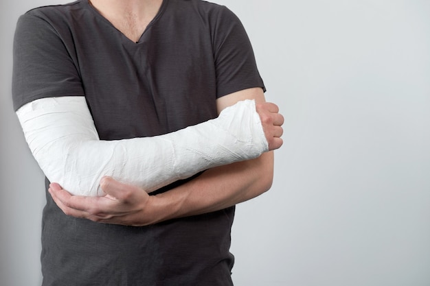 Close-up beeld van iemands arm met gipsverband op een witte muur