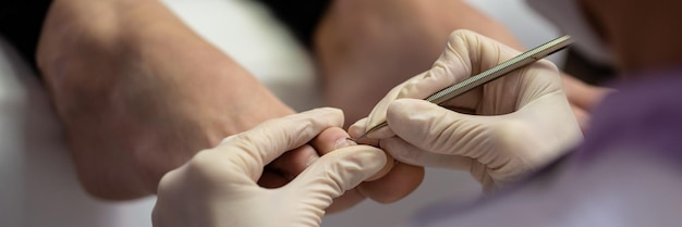 Close-up beeld van pedicure die dode huid van teennagels verwijdert met een professioneel cosmetisch hulpmiddel