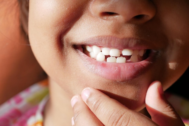 Close up of a child fry lip