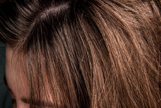 close up dandruff on woman hair