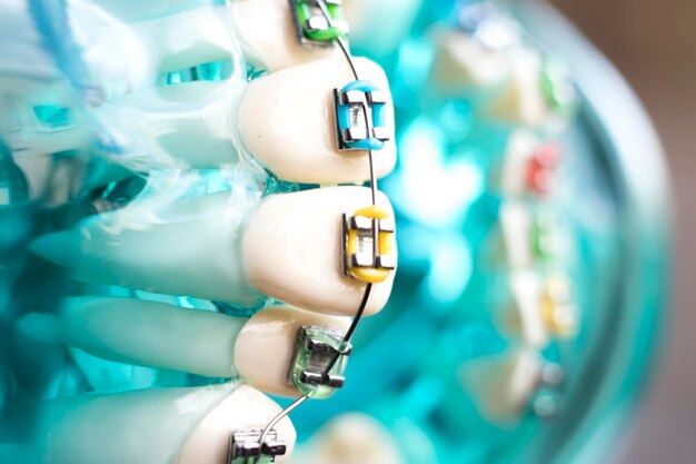 Photo close-up of dental equipment