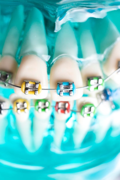 Foto prossimo piano delle apparecchiature dentali