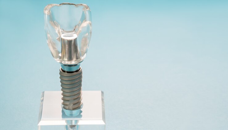 Close up dental implant  model on blue background.