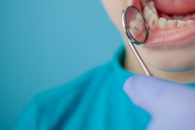 青い手袋の助手と歯科医の手のクローズアップは子供に歯を治療している、患者の顔は閉じられています