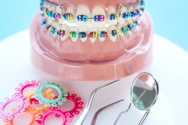 Close up dentist tools and orthodontic model  