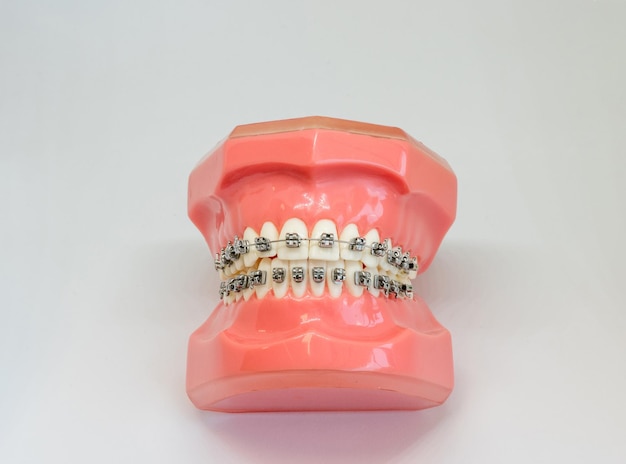 Close-up of dentures over white background