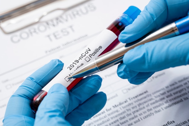 Close-up doctor checking medical samples