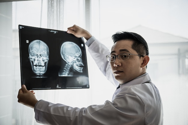 Close up of doctor holding x-ray, x-ray film of patient at hospital.