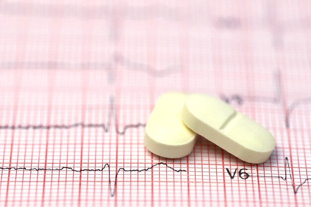 Close up of electrocardiograph with pills