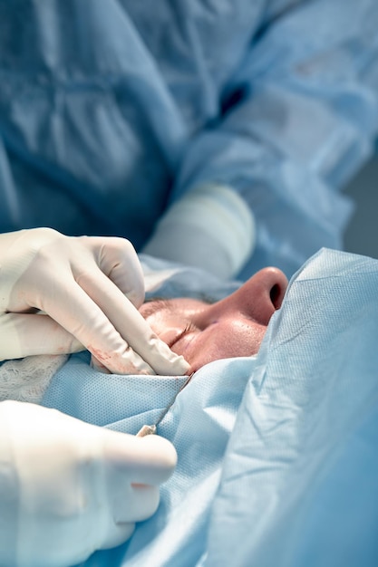 Крупный план лица пациента, которому делают блефаропластику Хирург разрезает веко и выполняет манипуляции с помощью медицинских инструментов