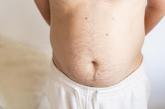 Close up of fat man's belly Perhaps the concept of abdominal pain bloating Health concept