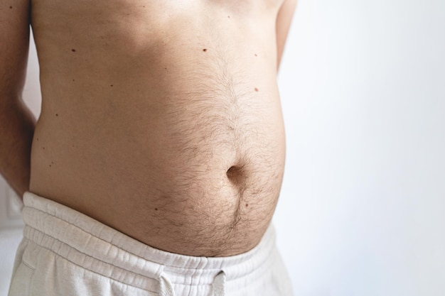 Close up of fat man's belly Perhaps the concept of abdominal pain bloating Health concept