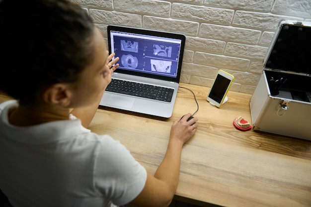 Close-up of a female doctor dentist sitting in front of a laptop with a panoramic x-ray of the human teeth and giving online consultation to a patient by video call about the dental treatment.