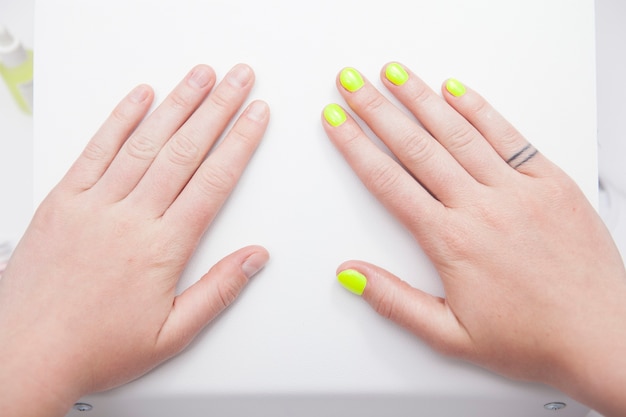 Close up of female hands before and after manicure