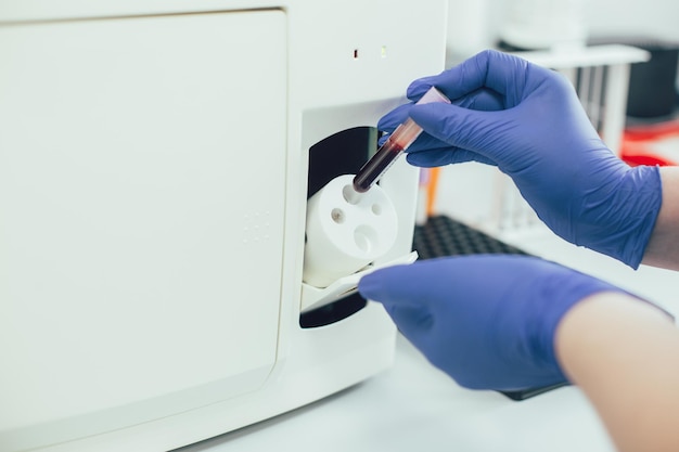 Close-up foto van handen in rubberen handschoenen die een reageerbuis met bloedmonster in een hematologieanalysator plaatsen
