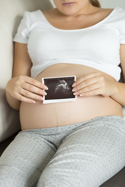 Close-up foto van zwangere vrouw met echografie