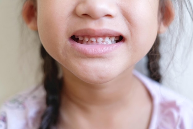 Foto close-up di una ragazza che mostra i denti