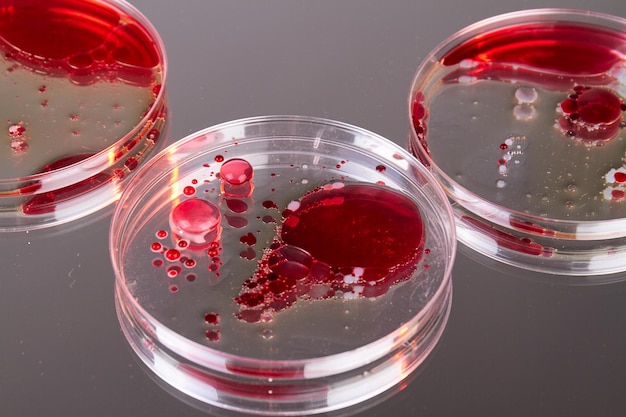 Photo close up of glass agars with blood samples petri dishes for scientific reserach