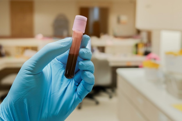 Foto close-up di un campione di sangue tenuto in mano in laboratorio