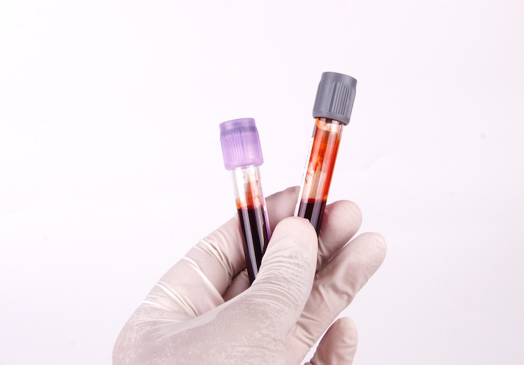 Photo close-up of hand holding blood sample in test tubes against white background