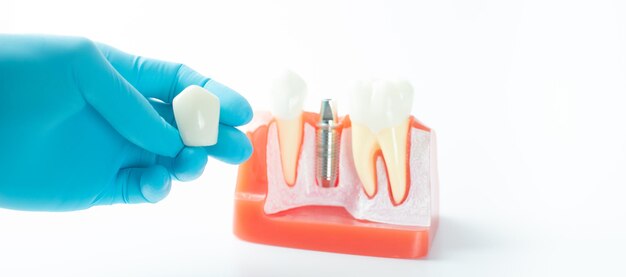 Close-up of hand holding dental equipment against white background