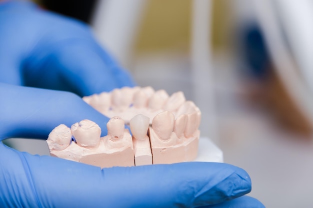 Close-up of hand holding dental implant