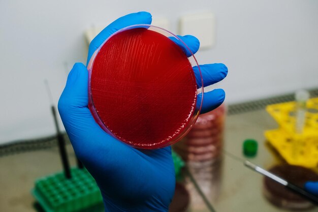 Foto close-up di un campione medico tenuto a mano in vetreria di laboratorio