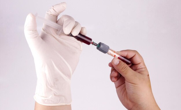 Photo close-up of hand injecting blood sample into test tube