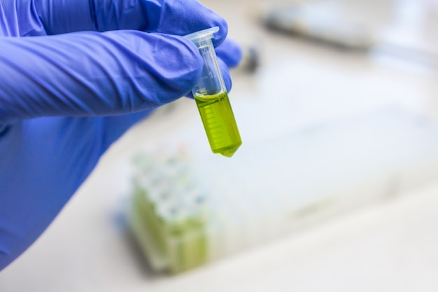 Close up to hands in blue gloves hold microtube with green liquid extract. Synthesis of new vaccine or drug against virus.