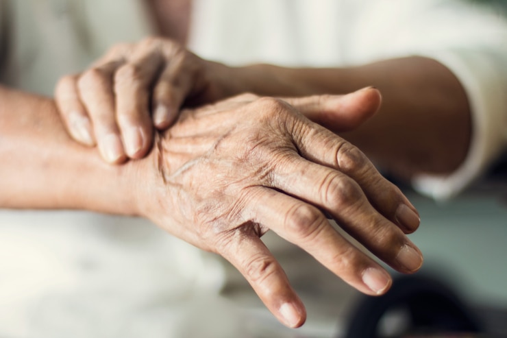 Photo close up hands of senior elderly woman patient suffering from pakinson's desease symptom