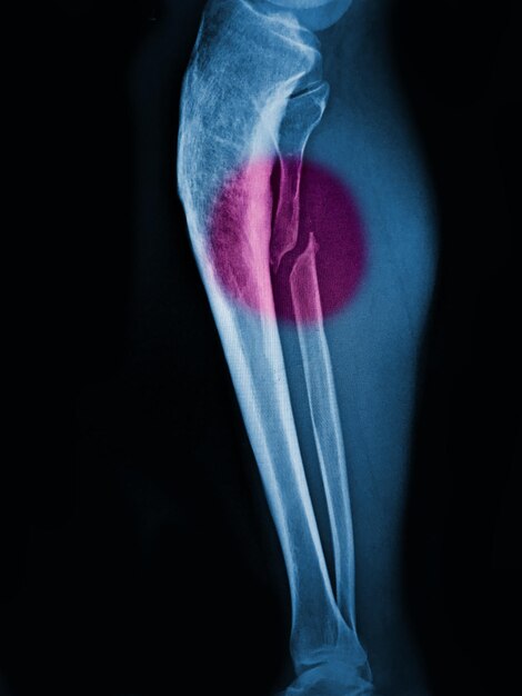 Photo a close up of a human elbow with a pink spot on the right arm.